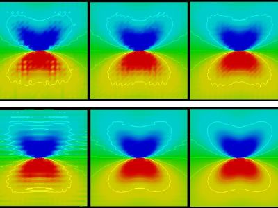 Stress field around dislocations
