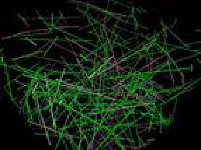 Fiber dynamics